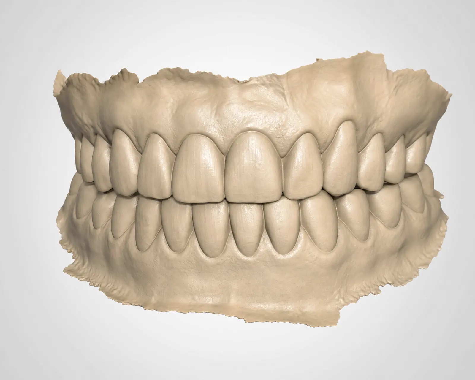 A 3D digital intraoral scan model of the upper and lower teeth, captured without messy molds