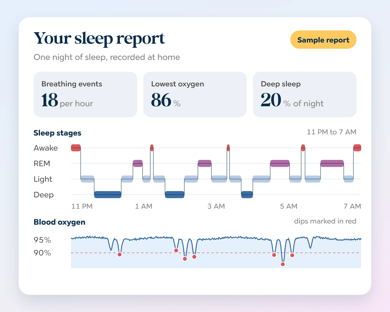 Sample home sleep test report showing breathing events per hour, lowest blood oxygen, time in deep sleep, a chart of sleep stages through the night, and a blood oxygen line with dips marked